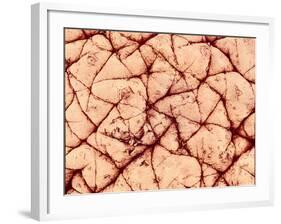 Human Skin Surface, SEM-Susumu Nishinaga-Framed Photographic Print