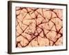 Human Skin Surface, SEM-Susumu Nishinaga-Framed Photographic Print