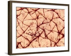 Human Skin Surface, SEM-Susumu Nishinaga-Framed Photographic Print