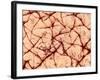 Human Skin Surface, SEM-Susumu Nishinaga-Framed Photographic Print