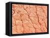 Human Skin-Micro Discovery-Framed Stretched Canvas