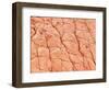 Human Skin-Micro Discovery-Framed Photographic Print