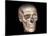 Human Skull, 3D CT Scan-null-Stretched Canvas