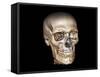 Human Skull, 3D CT Scan-null-Framed Stretched Canvas