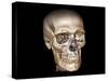 Human Skull, 3D CT Scan-null-Stretched Canvas