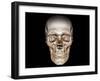 Human Skull, 3D CT Scan-null-Framed Photographic Print