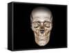 Human Skull, 3D CT Scan-null-Framed Stretched Canvas