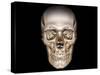 Human Skull, 3D CT Scan-null-Stretched Canvas