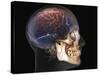 Human Skull and Brain, 3D CT Scan-null-Stretched Canvas