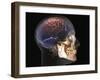 Human Skull and Brain, 3D CT Scan-null-Framed Photographic Print