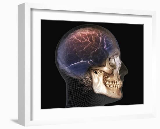 Human Skull and Brain, 3D CT Scan-null-Framed Photographic Print