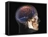 Human Skull and Brain, 3D CT Scan-null-Framed Stretched Canvas