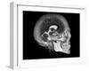 Human Skull and Brain, CT and MRI Scans-null-Framed Photographic Print