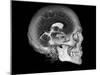 Human Skull and Brain, CT and MRI Scans-null-Mounted Photographic Print