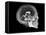 Human Skull and Brain, CT and MRI Scans-null-Framed Stretched Canvas