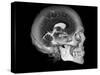 Human Skull and Brain, CT and MRI Scans-null-Stretched Canvas