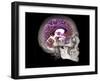 Human Skull and Brain, CT and MRI Scans-null-Framed Photographic Print