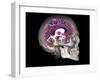 Human Skull and Brain, CT and MRI Scans-null-Framed Photographic Print