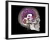 Human Skull and Brain, CT and MRI Scans-null-Framed Photographic Print