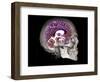 Human Skull and Brain, CT and MRI Scans-null-Framed Photographic Print