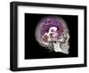 Human Skull and Brain, CT and MRI Scans-null-Framed Photographic Print