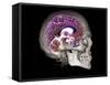 Human Skull and Brain, CT and MRI Scans-null-Framed Stretched Canvas