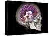 Human Skull and Brain, CT and MRI Scans-null-Stretched Canvas