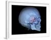 Human Skull and Site of Pituitary Gland, 3D CT Scan-null-Framed Photographic Print