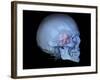 Human Skull and Site of Pituitary Gland, 3D CT Scan-null-Framed Photographic Print