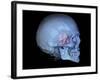 Human Skull and Site of Pituitary Gland, 3D CT Scan-null-Framed Photographic Print