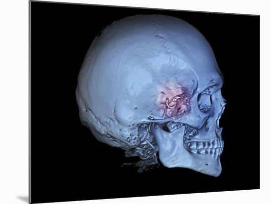 Human Skull and Site of Pituitary Gland, 3D CT Scan-null-Mounted Photographic Print