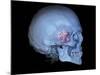 Human Skull and Site of Pituitary Gland, 3D CT Scan-null-Mounted Photographic Print