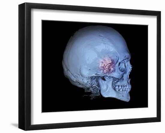 Human Skull and Site of Pituitary Gland, 3D CT Scan-null-Framed Photographic Print