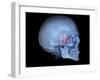 Human Skull and Site of Pituitary Gland, 3D CT Scan-null-Framed Photographic Print