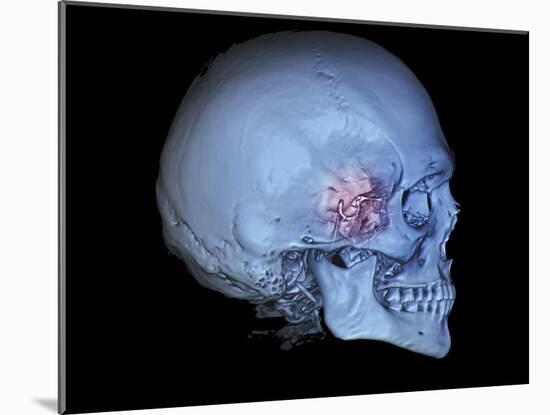 Human Skull and Site of Pituitary Gland, 3D CT Scan-null-Mounted Photographic Print