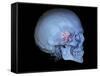 Human Skull and Site of Pituitary Gland, 3D CT Scan-null-Framed Stretched Canvas