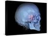 Human Skull and Site of Pituitary Gland, 3D CT Scan-null-Stretched Canvas