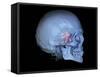 Human Skull and Site of Pituitary Gland, 3D CT Scan-null-Framed Stretched Canvas