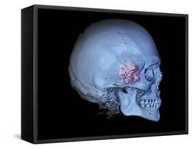 Human Skull and Site of Pituitary Gland, 3D CT Scan-null-Framed Stretched Canvas