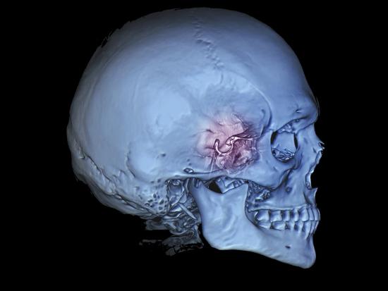 Photographic Print, , large