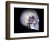 Human Skull and Site of Pituitary Gland, CT and MRI Scans-null-Framed Photographic Print