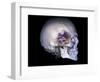 Human Skull and Site of Pituitary Gland, CT and MRI Scans-null-Framed Photographic Print