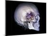 Human Skull and Site of Pituitary Gland, CT and MRI Scans-null-Mounted Photographic Print