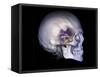 Human Skull and Site of Pituitary Gland, CT and MRI Scans-null-Framed Stretched Canvas