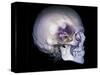 Human Skull and Site of Pituitary Gland, CT and MRI Scans-null-Stretched Canvas