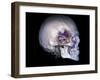 Human Skull and Site of Pituitary Gland, CT and MRI Scans-null-Framed Photographic Print