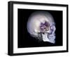 Human Skull and Site of Pituitary Gland, CT and MRI Scans-null-Framed Photographic Print