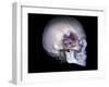 Human Skull and Site of Pituitary Gland, CT and MRI Scans-null-Framed Photographic Print