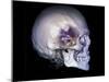 Human Skull and Site of Pituitary Gland, CT and MRI Scans-null-Mounted Photographic Print