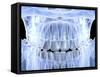 Human Skull with Teeth, Computer Artwork-PASIEKA-Framed Stretched Canvas